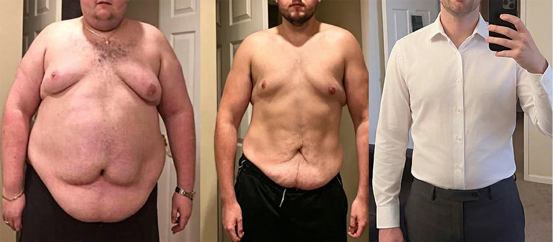 Three-stage male progression: before 100+ lb weight loss, after with loose skin, and compression undershirt under dress shirt. Temporary visual smoothing only.
